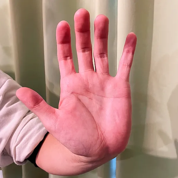 無料:手根フォーム